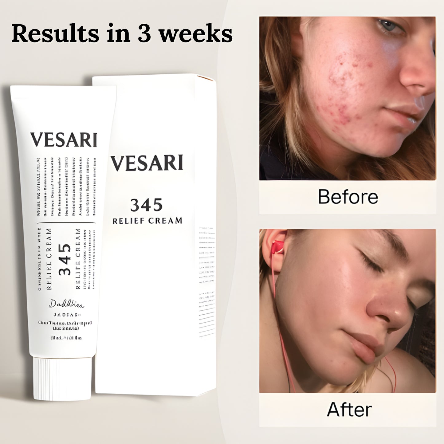 Vesari™ 345 Sensitive Relief Cream by Dr. Althea