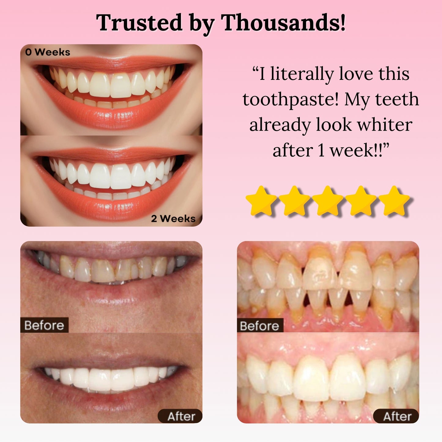 Vesari GlowSmile™