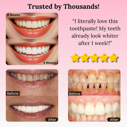 Vesari GlowSmile™